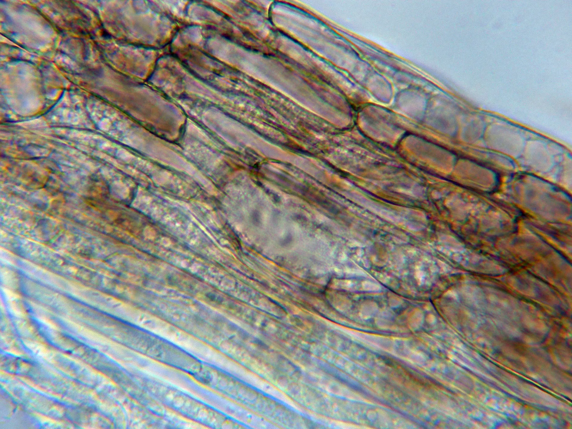 Microscopía de Pseudosperma obsoletum - 10 - Suprapellis agua -002